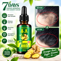 7 Days Ginger Germinal Hair Growth Serum