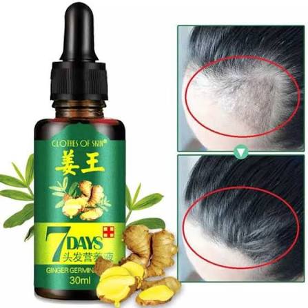 7 Days Ginger Germinal Hair Growth Serum